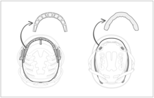 Casques Petzl